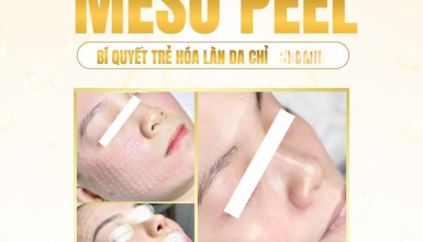 Cấy Meso Uy Tín Quận 6 – Làn Da Trẻ Khỏe, Căng Mướt Tại Thẩm Mỹ Madam Hồ