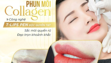 Phun Môi Uy Tín Quận 6 – Môi Hồng Tự Nhiên, Không Sưng Đỏ Tại Thẩm Mỹ Madam Hồ